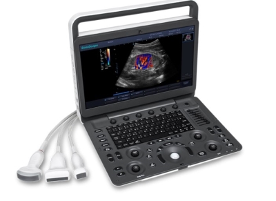 MÁY SIÊU ÂM XÁCH TAY E3 -SONOSCAPE 